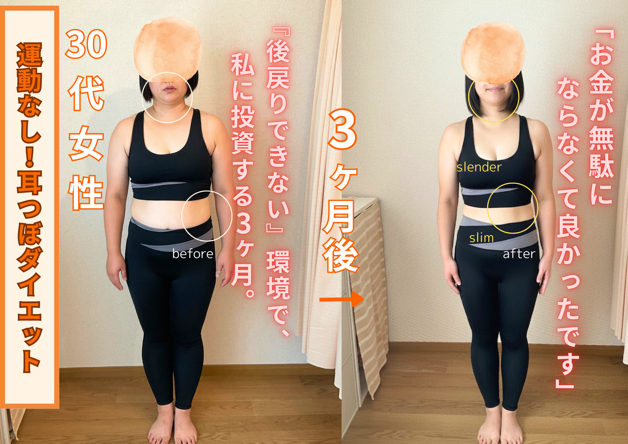 30代女性ビフォーアフター正面